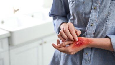 Junho Laranja mes de conscientização da prevenção das queimaduras