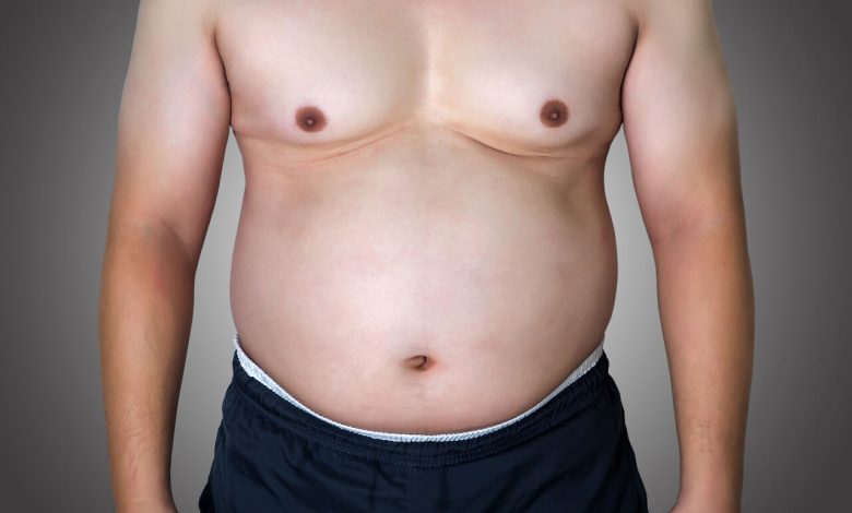 Não é só estética. A ginecomastia também impacta a autoestima masculina