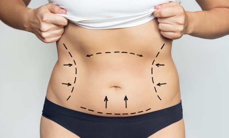 O pós-operatório é metade do resultado e quase ninguém fala sobre isso