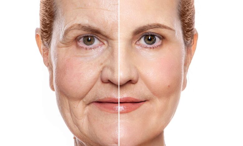 Onde está o limite entre cuidar da aparência e envelhecer com naturalidade